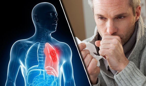 Pljučni rak – katerih znakov ne spreglejte in kako si lahko pomagate